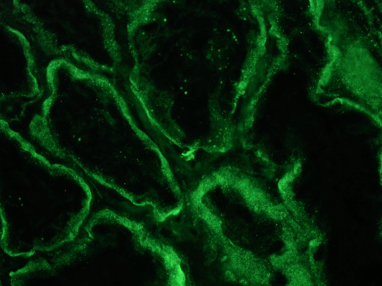 Figure 1: Integrin alpha 6B immunostaining of the basolateral membrane of epithelial cells in a frozen section of human kidney using MUB0905P at a 1:50 dilution.